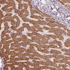 Immunohistochemical staining of human liver shows strong cytoplasmic positivity in hepatocytes.