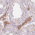 Immunohistochemical staining of human testis shows strong cytoplasmic positivity in Leydig cells.