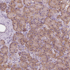 Anti-EPHX1 Antibody