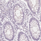 Immunohistochemical staining of human colon shows no positivity in glandular cells as expected.