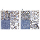 Immunohistochemical staining of human duodenum, kidney, lymph node and placenta using Anti-ACADVL antibody HPA020595 (A) shows similar protein distribution across tissues to independent antibody HPA019006 (B).