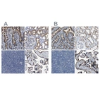 Immunohistochemical staining of human duodenum, kidney, lymph node and placenta using Anti-ACADVL antibody HPA020595 (A) shows similar protein distribution across tissues to independent antibody HPA019006 (B).