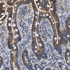 Immunohistochemical staining of human duodenum shows strong cytoplasmic positivity in glandular cells.