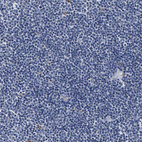 Immunohistochemical staining of human lymph node shows only weak cytoplasmic positivity in a subset of non-germinal center cells.