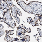Immunohistochemical staining of human placenta shows strong cytoplasmic positivity in trophoblastic cells.