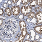 Immunohistochemical staining of human kidney shows moderate cytoplasmic positivity in cells in tubules.