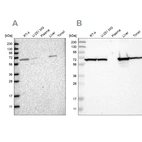 Western blot analysis using Anti-ACADVL antibody HPA020595 (A) shows similar pattern to independent antibody HPA019006 (B).