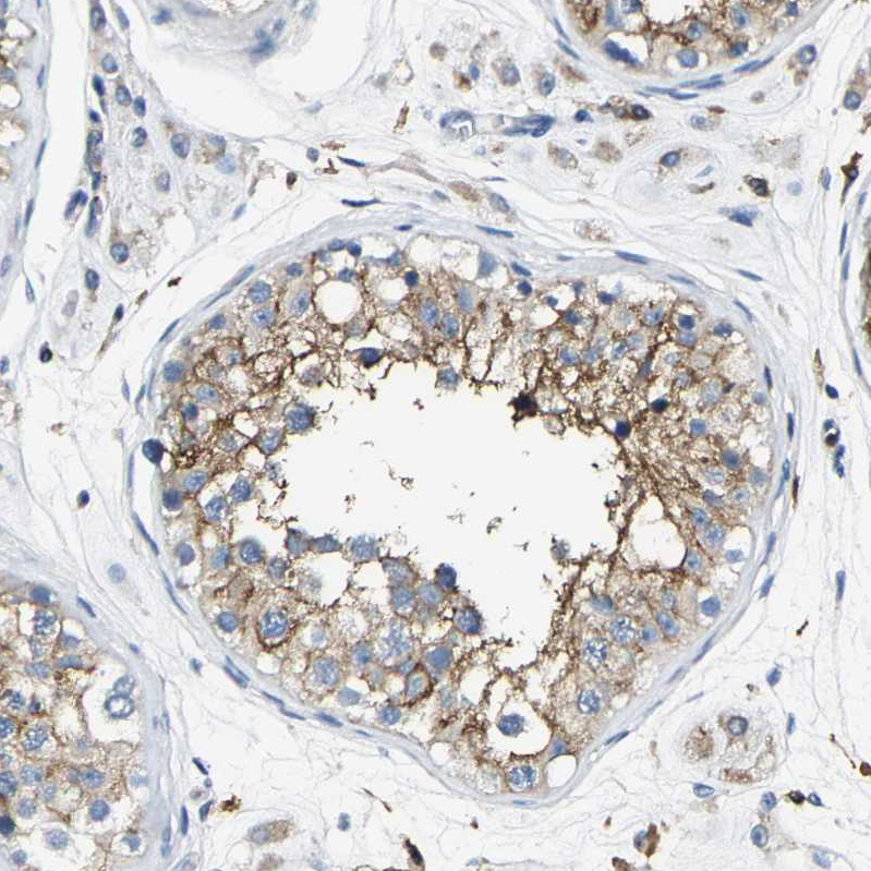 Anti-TRAF6 Antibody