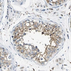 Anti-TRAF6 Antibody