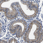 Immunohistochemical staining of human endometrium shows moderate cytoplasmic/ membranous positivity in glandular cells.