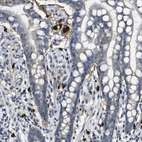 Immunohistochemical staining of human colon shows strong cytoplasmic positivity in lymphoid cells.