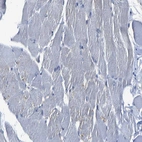 Immunohistochemical staining of human skeletal muscle shows no positivity in myocytes as expected.