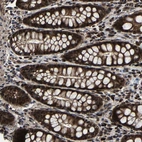 Anti-ZCCHC7 Antibody