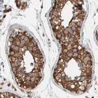 Immunohistochemical staining of human testis shows strong cytoplasmic positivity in cells in seminiferous ducts.