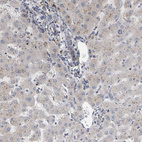 Immunohistochemical staining of human liver very weak cytoplasmic positivity in hepatocytes.