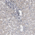 Immunohistochemical staining of human liver very weak cytoplasmic positivity in hepatocytes.