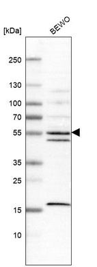 Western blot analysis in human cell line BEWO.