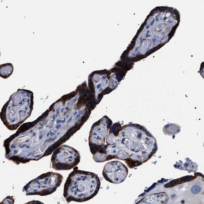 Anti-SVEP1 Antibody