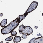 Anti-SVEP1 Antibody