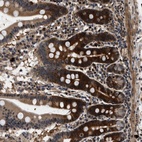 Anti-ZCCHC6 Antibody