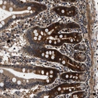 Anti-ZCCHC6 Antibody