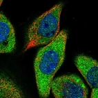 Immunofluorescent staining of human cell line A-431 shows localization to cytosol.