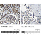 Anti-KIAA1958 Antibody