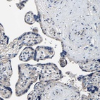 Anti-KIAA1958 Antibody