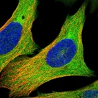 Immunofluorescent staining of human cell line U-2 OS shows localization to plasma membrane & cytosol.