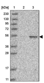 Anti-CCNA2 Antibody