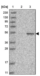 Lane 1: Marker [kDa] 230, 130, 95, 72, 56, 36, 28, 17, 11_br/_Lane 2: Human cell line RT-4_br/_Lane 3: Human cell line U-251MG sp