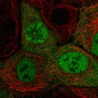 Immunofluorescent staining of human cell line A-431 shows localization to nucleoplasm & cytosol.