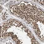 Immunohistochemical staining of human testis shows strong nuclear positivity in cells in seminiferous ducts.
