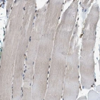 Immunohistochemical staining of human skeletal muscle shows weak cytoplasmic positivity in myocytes.