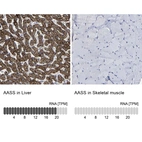 Anti-AASS Antibody
