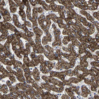 Immunohistochemical staining of human liver shows strong granular cytoplasmic positivity in hepatocytes.