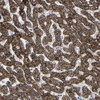 Immunohistochemical staining of human liver shows strong granular cytoplasmic positivity in hepatocytes.