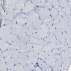 Immunohistochemical staining of human skeletal muscle shows no positivity in myocytes as expected.