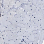 Immunohistochemical staining of human skeletal muscle shows no positivity in myocytes as expected.