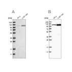 Western blot analysis using Anti-AASS antibody HPA020637 (A) shows similar pattern to independent antibody HPA020728 (B).