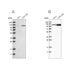 Western blot analysis using Anti-AASS antibody HPA020637 (A) shows similar pattern to independent antibody HPA020728 (B).