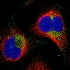 Immunofluorescent staining of human cell line U-2 OS shows localization to mitochondria & vesicles.