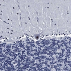 Immunohistochemical staining of human cerebellum shows moderate nuclear positivity in Purkinje cells.