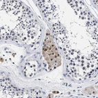 Immunohistochemical staining of human testis shows moderate nuclear positivity in Leydig cells.
