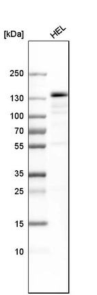 Western blot analysis in human cell line HEL.