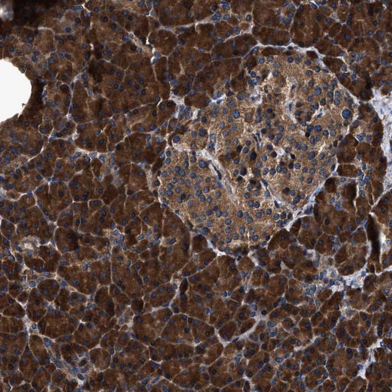 Anti-ZMYND19 Antibody