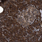 Anti-ZMYND19 Antibody
