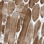 Immunohistochemical staining of human skeletal muscle shows strong cytoplasmic positivity in myocytes.