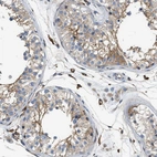 Anti-NSUN7 Antibody