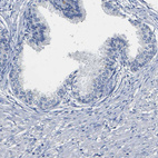 Immunohistochemical staining of human prostate shows no positivity in glandular cells as expected.